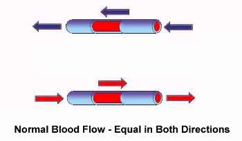 Blood flow